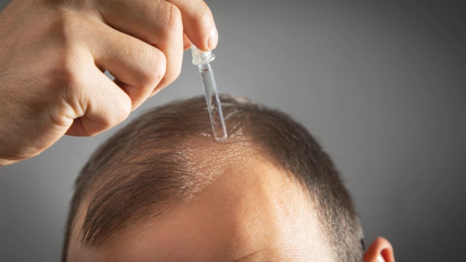 Saw Palmetto impact on Hair Growth